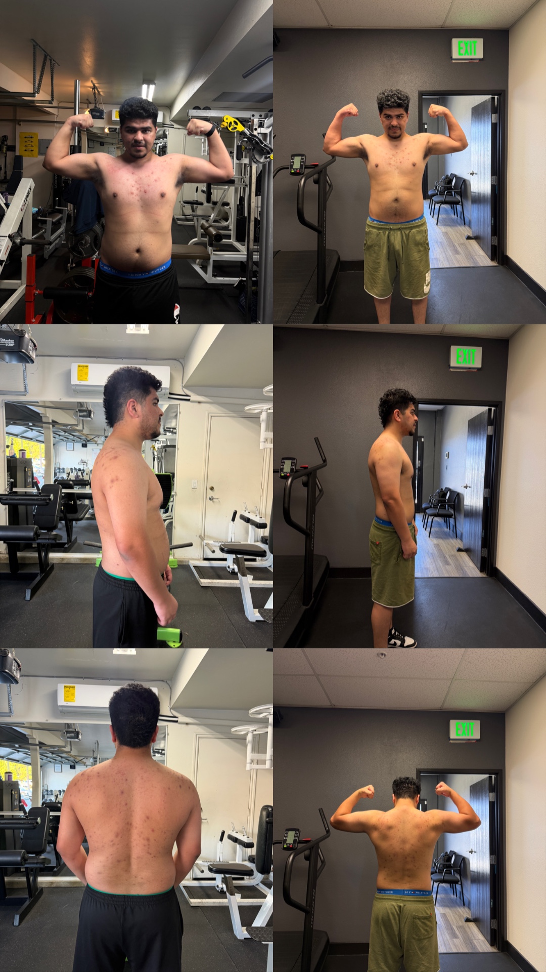 Eddie — Down 26 lbs · Cleared skin & confidence